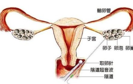 2026在乐山市做基因检测多少钱？基因筛查可以规避哪些遗传病？