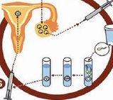 在南阳做一次第二代试管婴儿需要多长时间？费用情况如何？