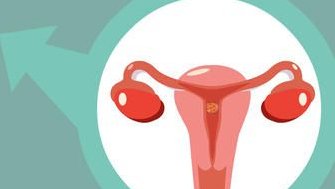 盆腔炎试管用什么方案？盘腔炎试管方案流程解读！